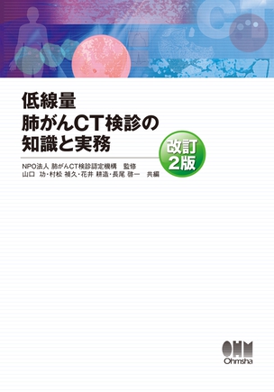 低線量肺がんCT検診の知識と実務（改訂2版）