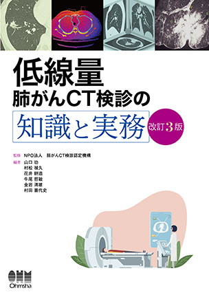 低線量肺がんCT検診の知識と実務（改訂3版）